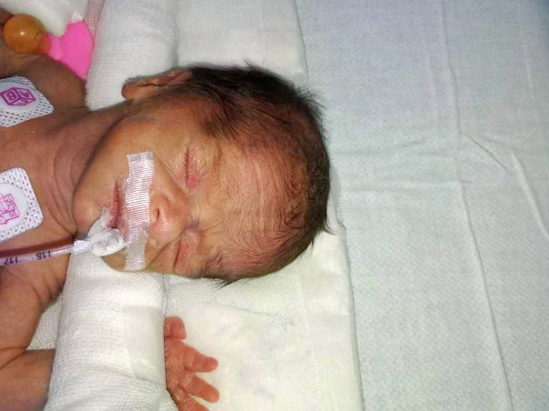 Need help!! To save ur little angles twins in critical condition