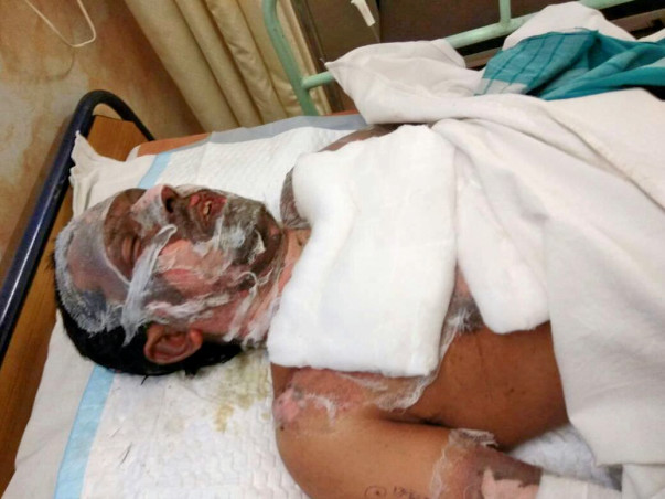 Help Pradeep Nayak(29 Yr) To Fight The Battle For His Life