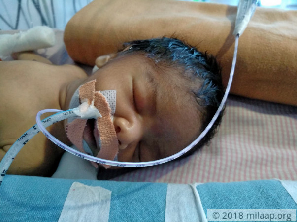 This baby is in a critical state and needs our help to live