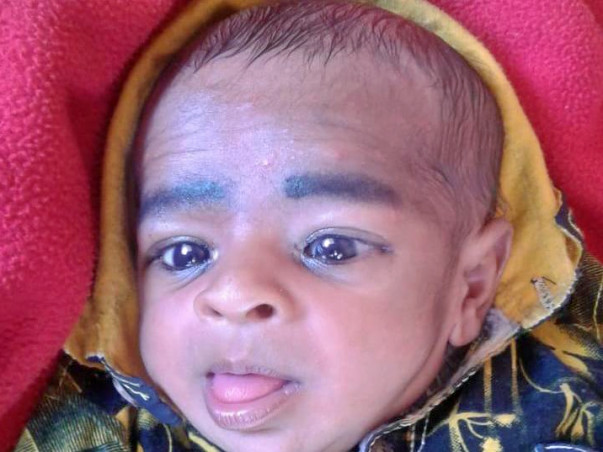 Support Rishabh Nisad Recover From Valvular Heart Disease