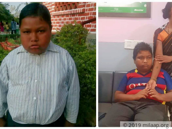 Help Pankaj Kumar Fight Bardet Biedl Syndrome
