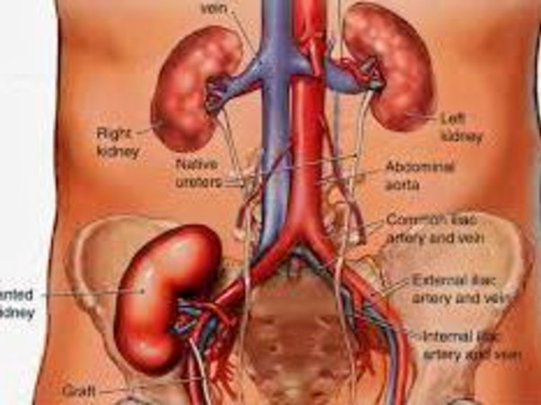 Help Subhash Kumar Choudhary Undergo Kidney Transplant
