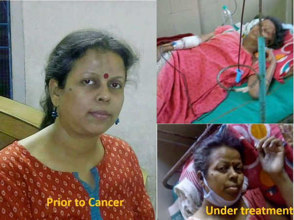 Help Mahua fight Cancer (CLL with p53 mutation)!