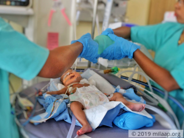 Parents Who Have Already Lost A Child Struggle To Save 1-Month-Old