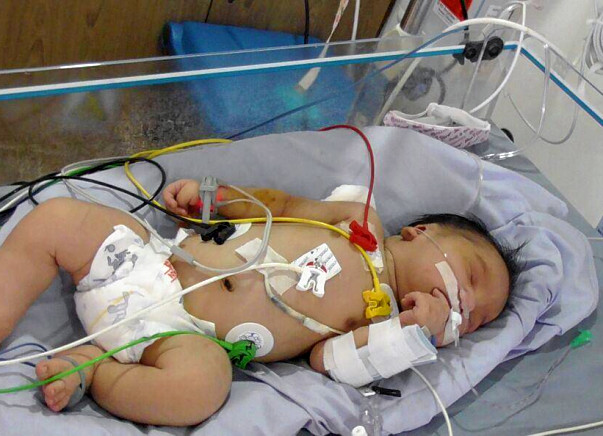 Help These Parents Save The Life Of Their New Born Baby