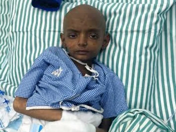 7-Year-Old Ansh Fights A Terrible Disease And Needs Our Help To Live