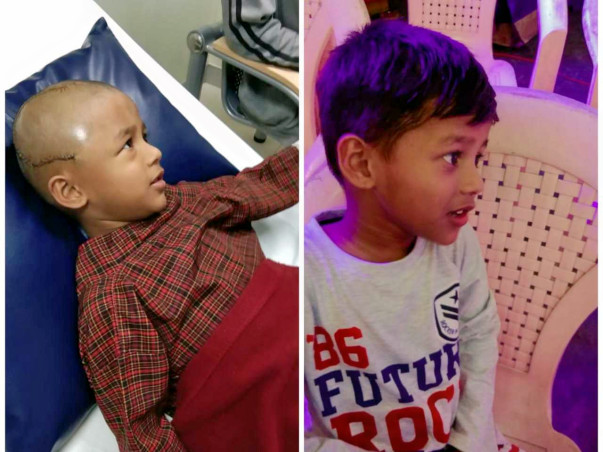 Help 5-year-old Jaidev Fight Brain Tumour