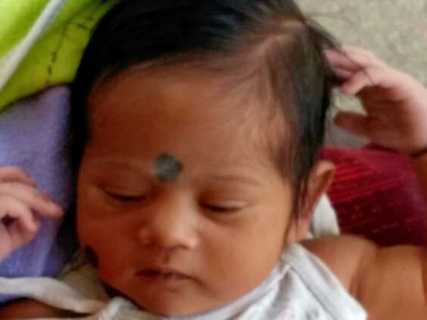 One Month Old Baby Needs Your Support For A Heart surgery