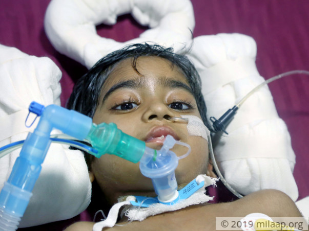4-Year-Old Paralyzed Due To Rare Disease Needs Urgent Help