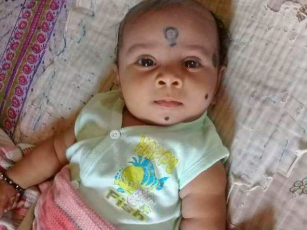 Help Baby Shiva Srinidh Kalakota Who Is Suffering From Kidney Ailment