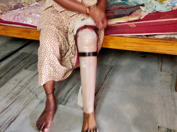 Help My Aunt Get A Flexible Prosthetic Leg