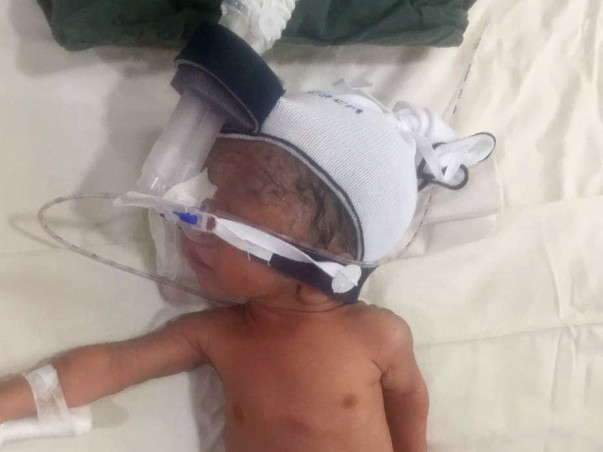 Help Baby Of Neha Recover From Ecoli Septicemia