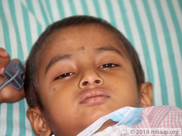 4-year-old Is In Constant Pain Due To A Dreadful Cancer