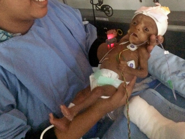 Help My Premature Baby