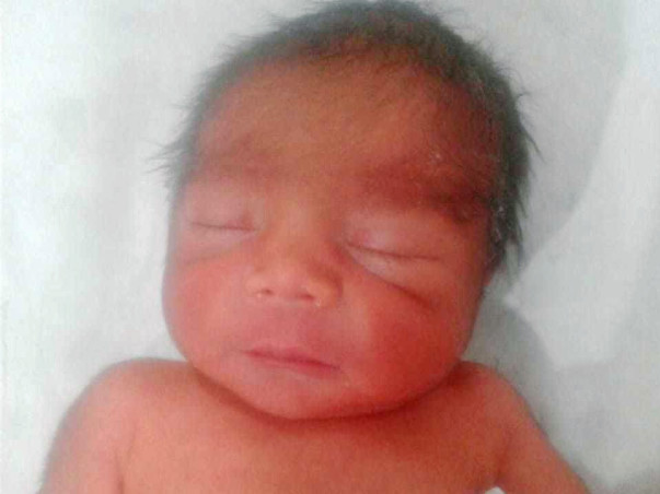 Support Premature Baby Born at 28 Weeks