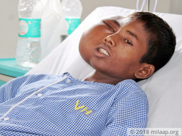 15-Year-Old With Rare Facial Tumor Will Die Without Treatment