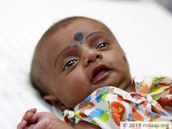 2 மாத குழந்தையின் இதய அறுவை சிகிச்சைக்கு உதவுங்கள்
