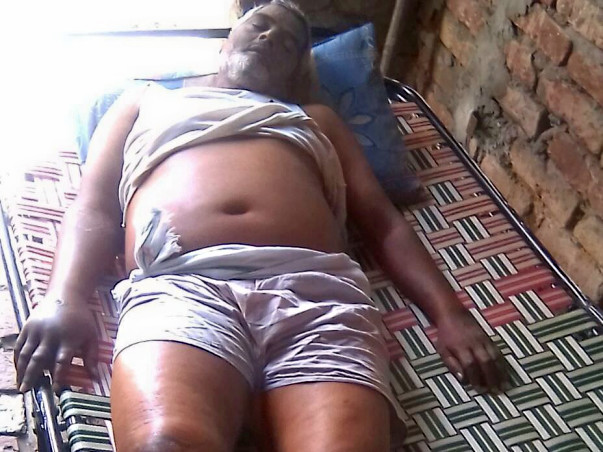 Poor Man On Verge Of Death Due To A Stomach Tumor Needs Your Help