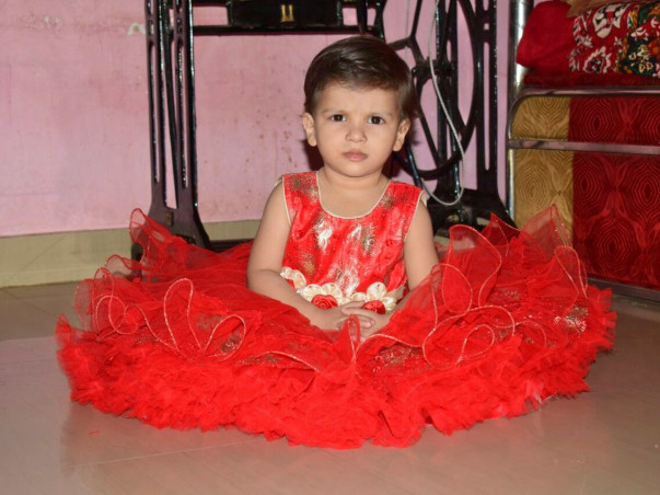 Help My 3 Year Old Daughter To Overcome Congenital Anomaly