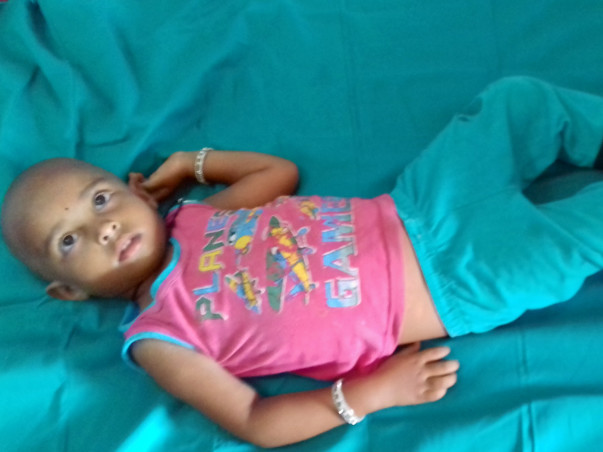 3-year-old Rithu needs your help to undergo a liver transplant
