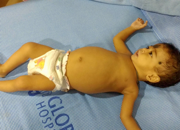 After Loosing Two Babies,Now This 9-Month-Old Baby Is Their Only Hope