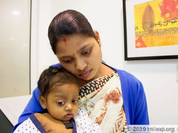 Baby Ekanshi's Liver Is Severely Damaged, Needs A Transplant To Live