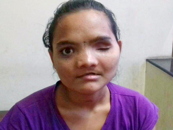 Help Vaishali Reclaim Her Life After A Horrific Accident