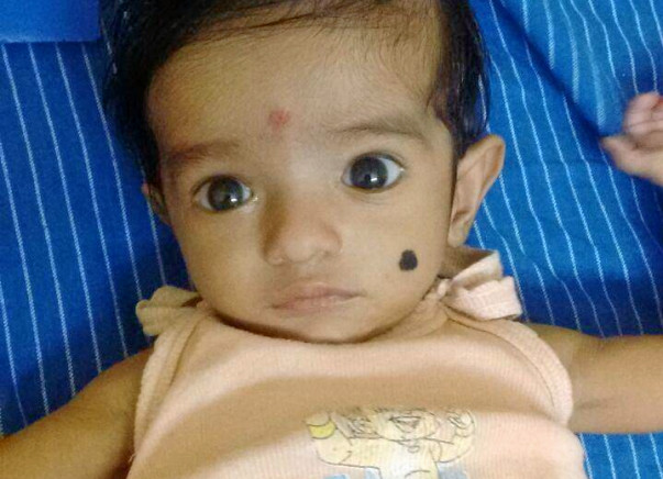 Need helping hands to save little baby boy
