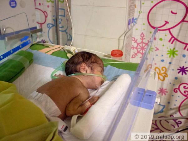 Baby of Pooja needs your help to survive