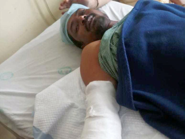 Help Mahmood Shaikh to get Prosthetic hand
