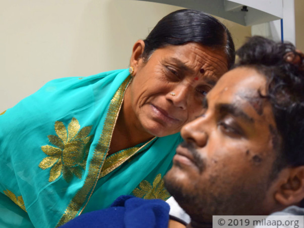 Help My Brother Sathish to recover from Road Accident