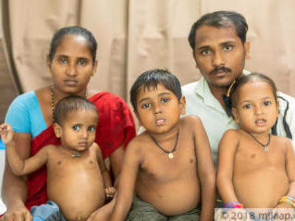 Poor Parents' All 3 Kids Have Severe Liver Disease, Need Urgent Help