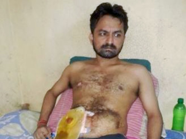 Help Pankaj Undergo His 8th Operation