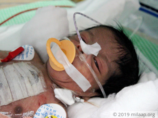 Baby of Lavanya needs your help to survive