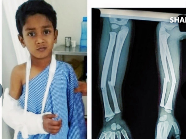 Help My Brother Recover From Fatal Accident