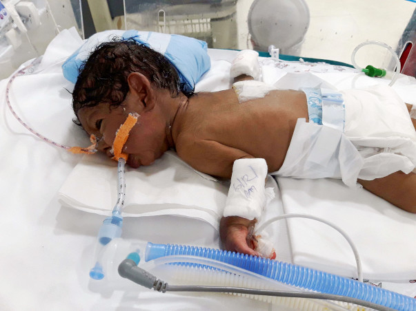 Support This Father Save His 1 Month Old Daughter