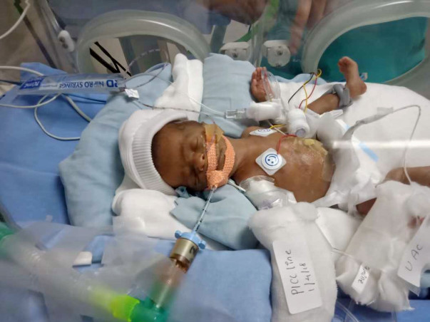 Help my premature baby who is struggling in ICU