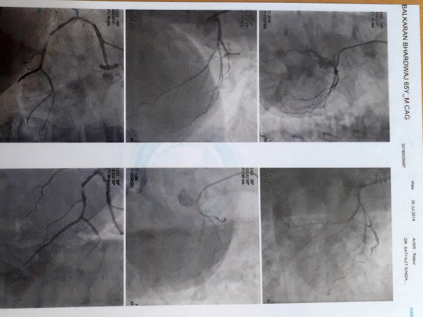 Help Me Undergo Heart Surgery