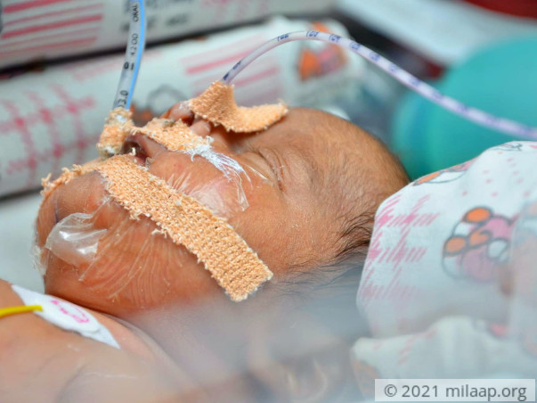 Help Baby of Priya Recover