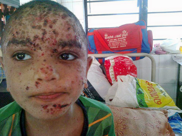 Help Thanseeh for Bone Marrow transplantation