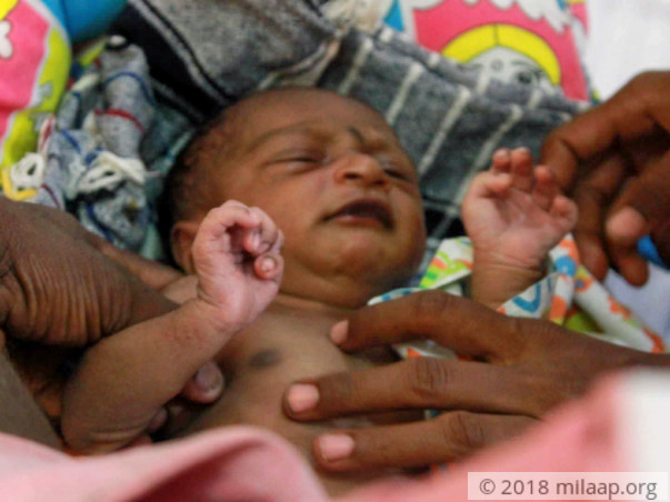 Farmers Have Only 1 Week Left To Save Baby With Multiple Heart Defects