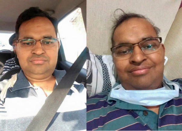 Vineet's fight against blood cancer (Please show your generosity)