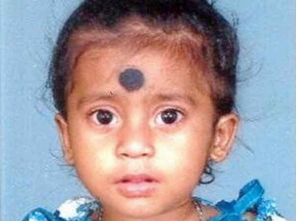 Help little Asha with her heart surgery
