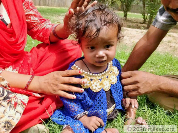 1-Year-Old Baby Disha's Failing Heart Has Almost Killed Her Twice