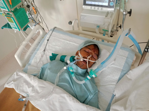Help 19-year-old-Pratik fight in the ICU after a severe road accident
