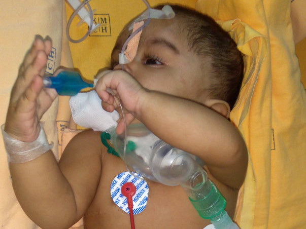 Help 9 Month Old Baby Danasri Fight Against Tracheostomy