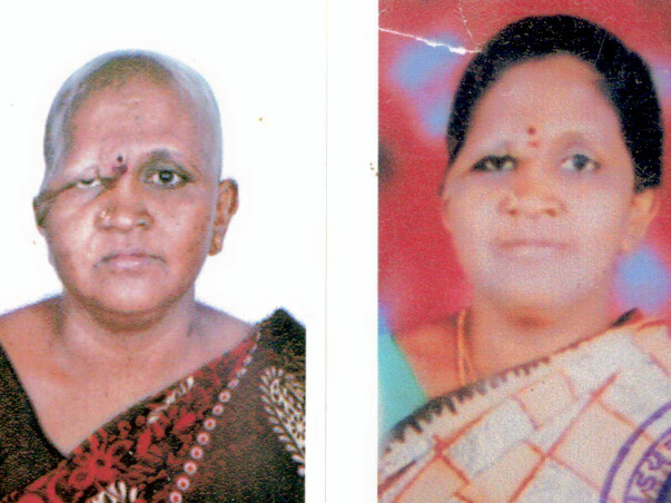 Rathna needs to undergo chemo to live for her 2 disabled daughters: