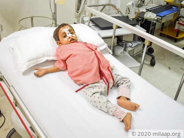 Help Rudra Fight Biliary Atresia with a lifesaving Liver Transplant