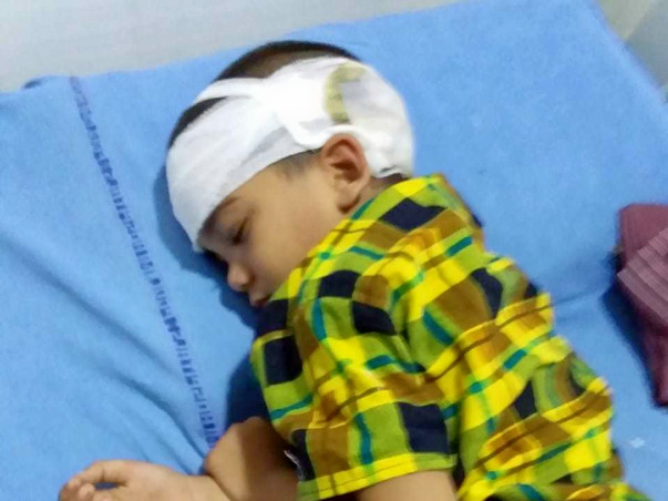 Help mahesh for brain surgery