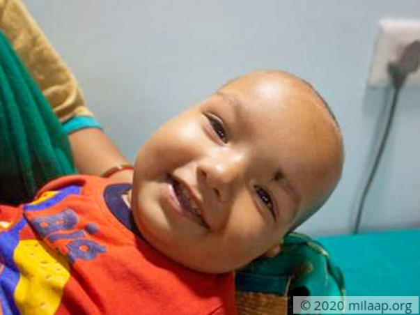 9-Month-Old Whose Breathlessness Doesn't Let Him Sleep Beyond 15 Mins